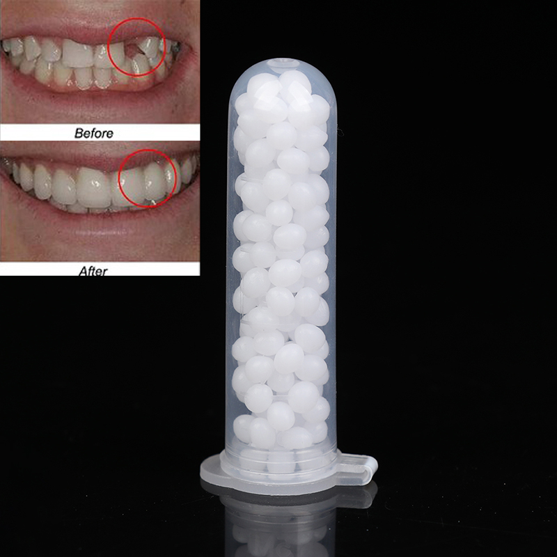 【K】1箱入り、一時的な歯の補修キット。歯と歯の隙間を埋める - Teeth Whitening Kit のレビューと価格