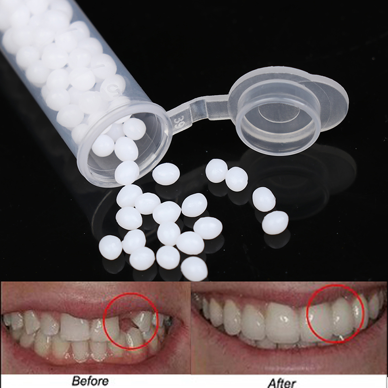 【K】1箱入り、一時的な歯の補修キット。歯と歯の隙間を埋める - Teeth Whitening Kit のレビューと価格
