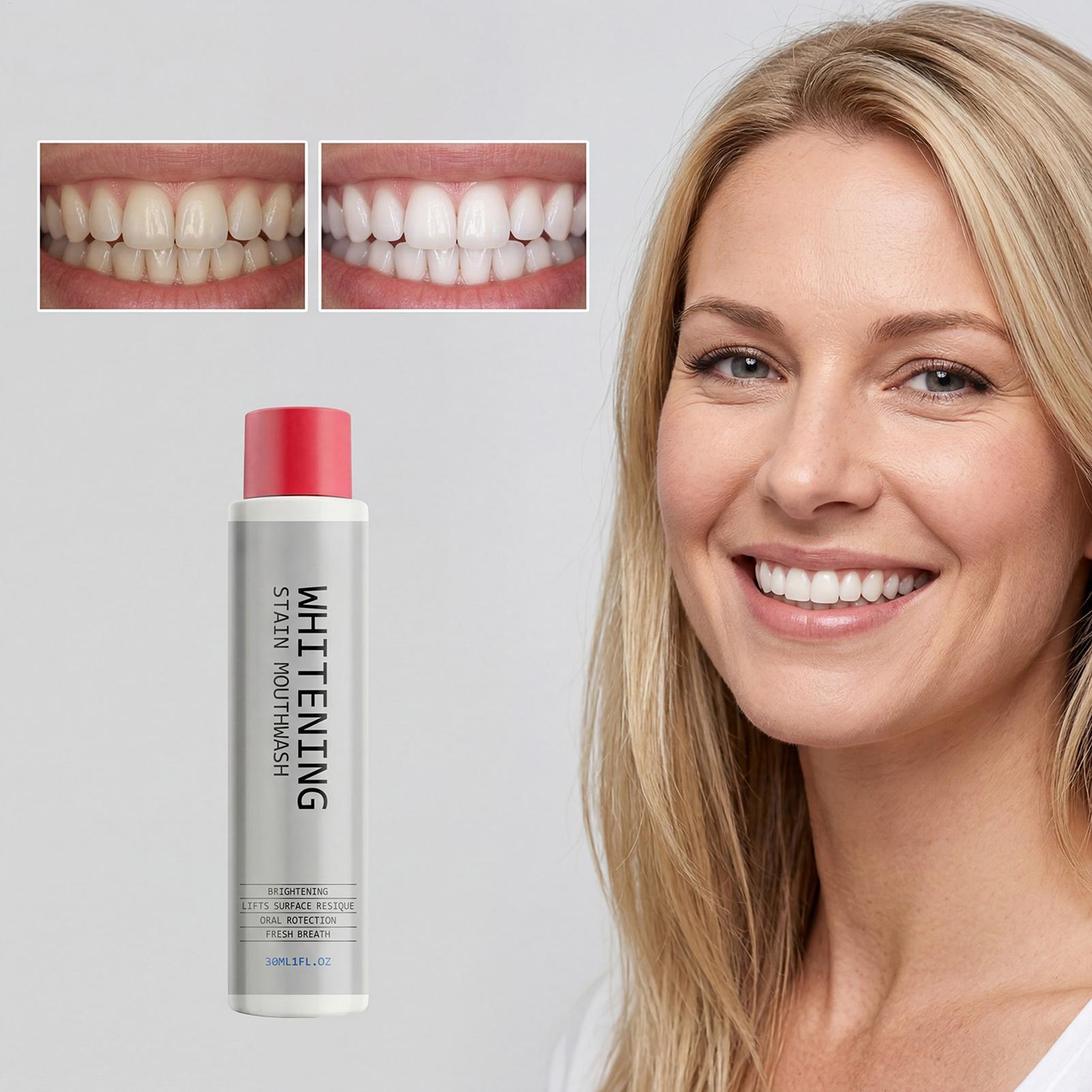 30ml ステインホワイトニングマウスウォッシュ、臭いを除去 - Teeth Whitening Mouthwash のレビューと価格