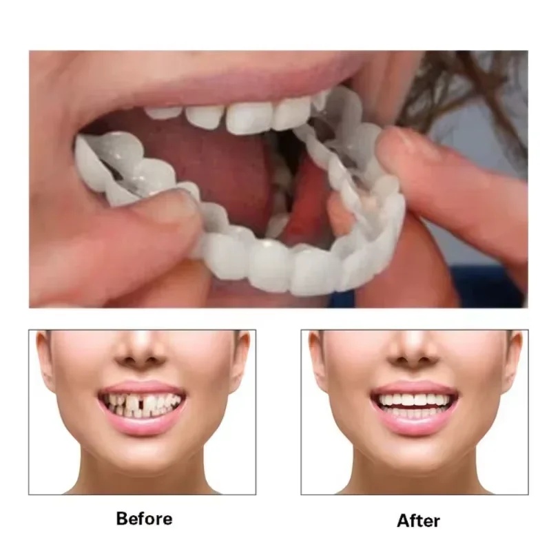 装着式のベニア歯キット。調整可能な美容用歯科ベニア。男性・女 - Teeth Whitening Kit のレビューと価格
